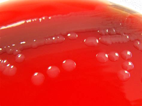 vibrio cholerae en agar sangre